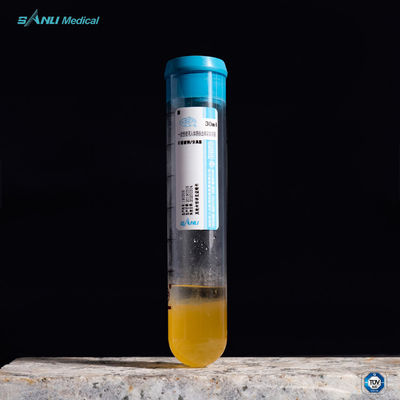 15ml PRPの管は苦痛ACD-A PRPのゲルの分離器の管を取り除く