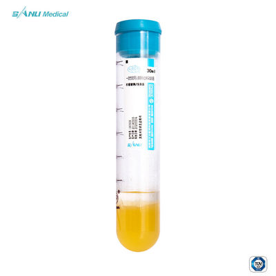 OAの処置のためのゲルとの苦痛PRPの試験管20ml ACD-Aを取り除きなさい